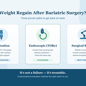Bariatric Revision Surgery: Your Options for Weight Regain After Gastric Sleeve or Bypass